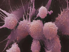 阿比特龙治疗前列腺癌何要与泼尼松联用？