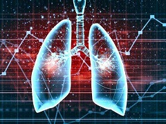 度伐鲁单抗联合治疗肺癌中的安全性和活性