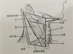 凡德他尼的注意事项