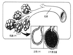 帕博西尼简介