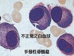 来那度胺上市的历程