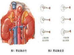 帕唑帕尼对于软组织肉瘤的治疗