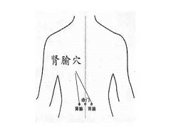 阿西替尼副作用有哪些