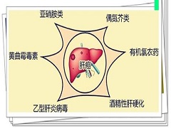 乐伐替尼对肝癌的控制率优于索拉非尼！