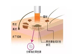 曲美替尼怎么用