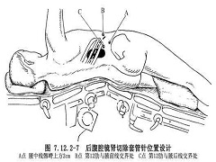 服用阿西替尼治肾癌