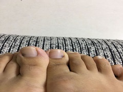达拉非尼联合曲美替尼治疗转移性非小细胞肺癌