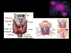 凡德他尼副作用有哪些