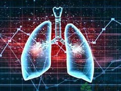 同为二代ALK肺癌靶向药布加替尼活性是克唑替尼的10倍