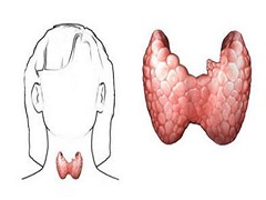 凡德他尼抑制甲状腺癌的原理是什么？