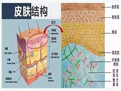 隆突性皮肤纤维肉瘤该如何处理