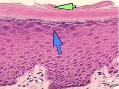 苏金单抗用于治疗牛皮癣的抗IL-17A生物制剂的综述